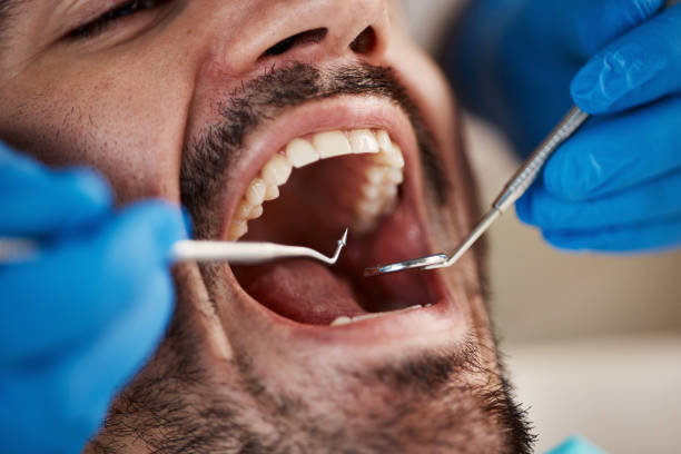 Best Emergency Cosmetic Dentistry in Onset, MA